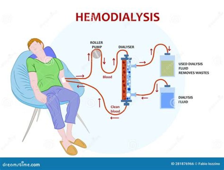 Do dialysis patients pee?