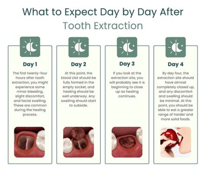 Do I need a ride home after wisdom teeth removal?