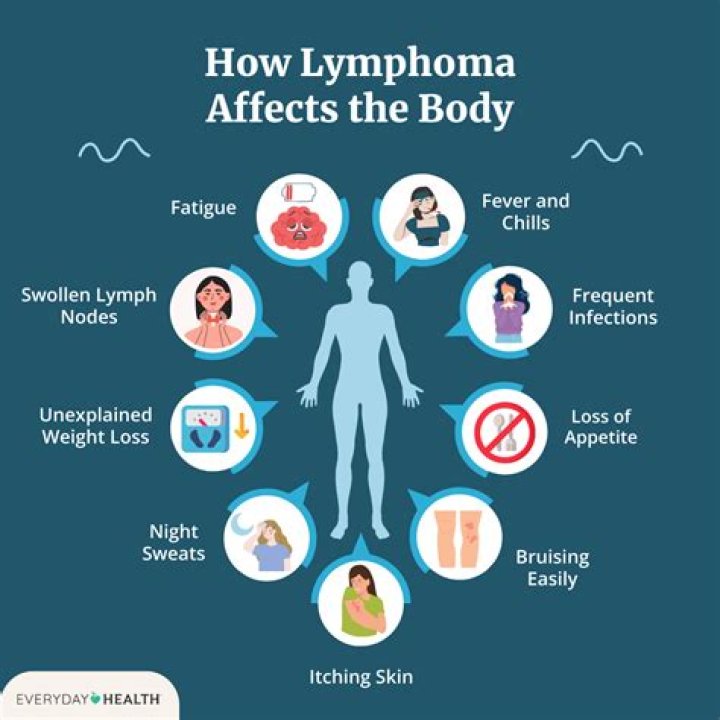 Do you feel sick if you have lymphoma?