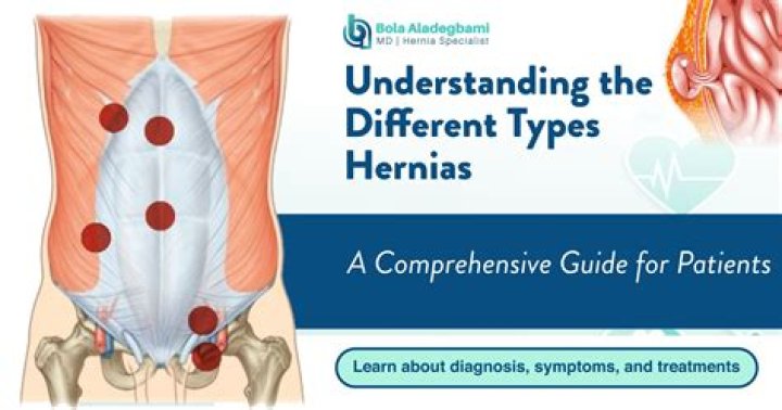 Does a hernia feel hard to the touch?