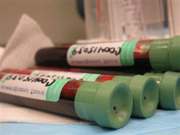 Does blood smell like a penny?