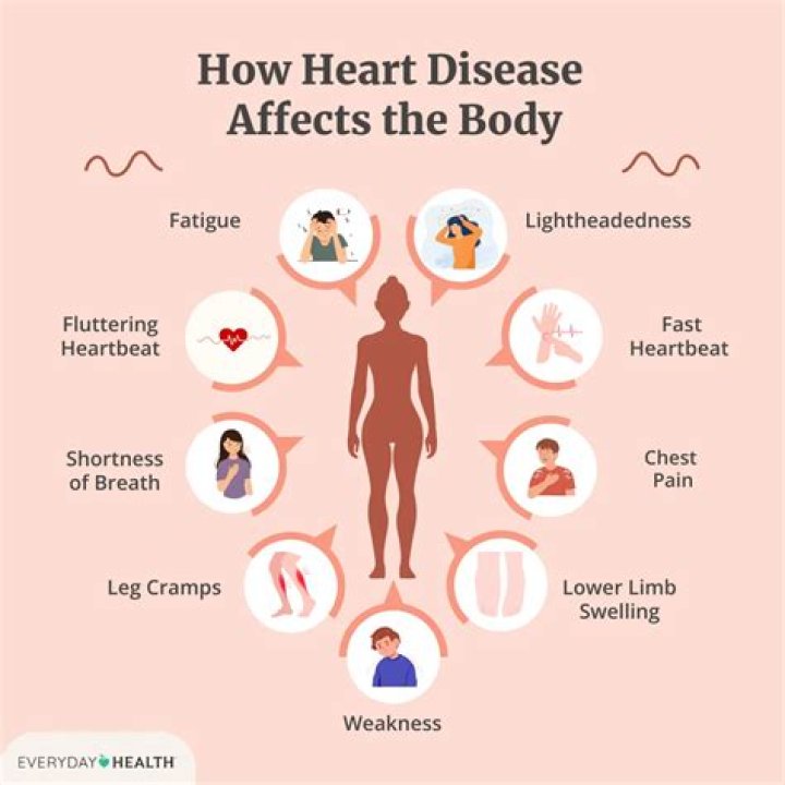 Does Boniva cause heart problems?