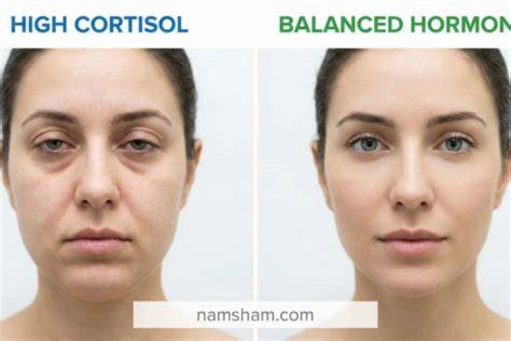 Does cortisol affect eyes?