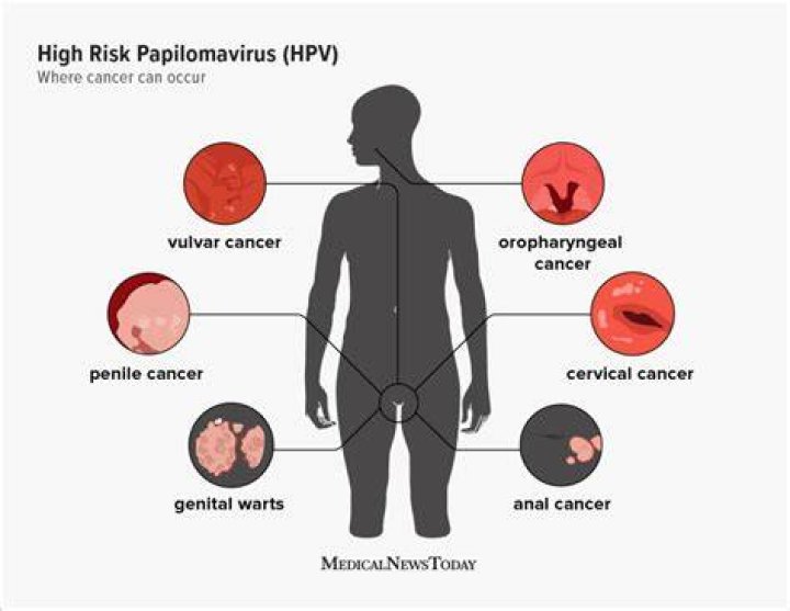 Does high risk HPV go away?
