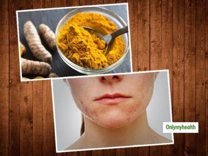 Does honey and turmeric remove dark spots?