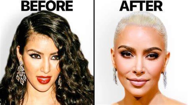 Does Kim K use filler?