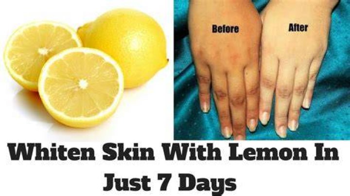 Does lemon permanently lighten skin?