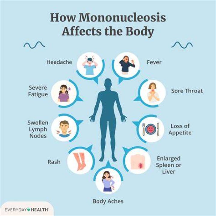 Does mono affect sleep?