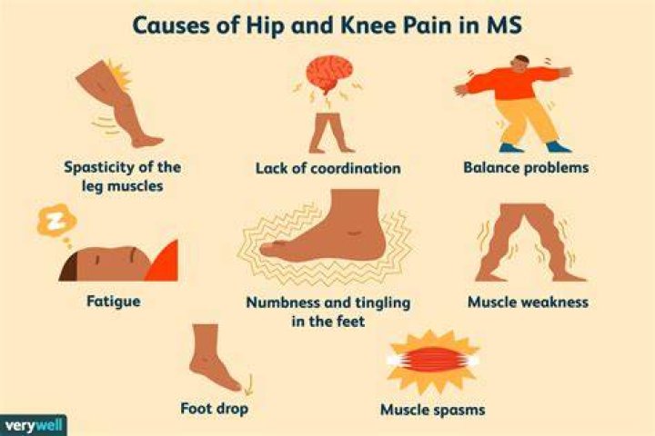 Does MS cause leg pain?