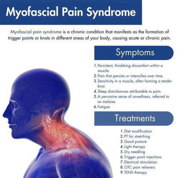 Does myofascial pain syndrome ever go away?