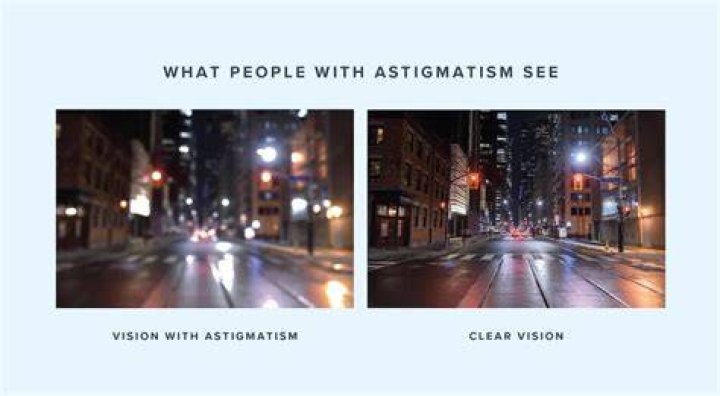 Does PRK cause astigmatism?
