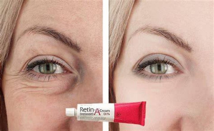 Does Retin-A restore collagen?
