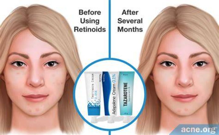 Does retinol help scars?