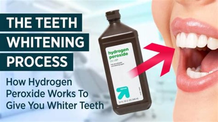 Does rinsing with peroxide help gums?