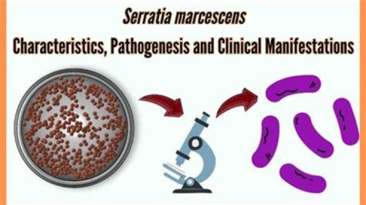 Does Serratia marcescens hydrolyze casein?