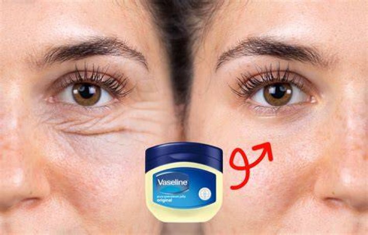 Does Vaseline help hyperpigmentation?