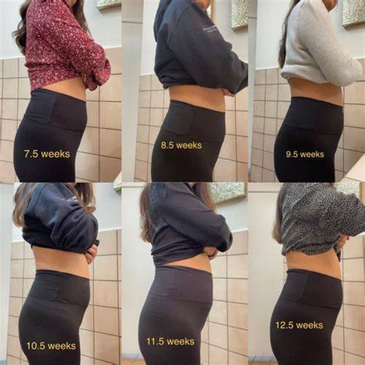 Does your waist get bigger after pregnancy?