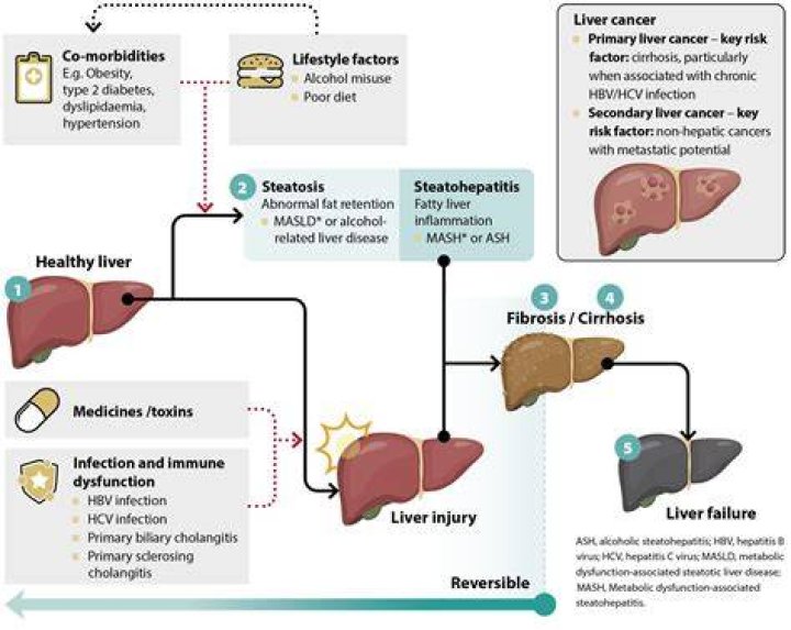 How can I lower my liver enzymes fast?
