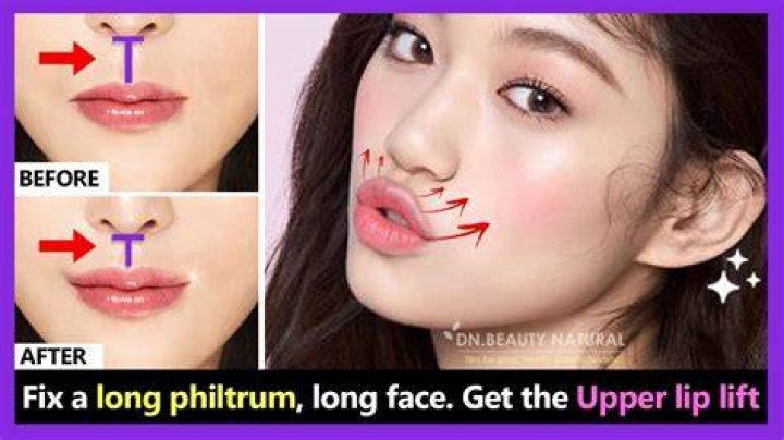 How can I make my Philtrums longer?