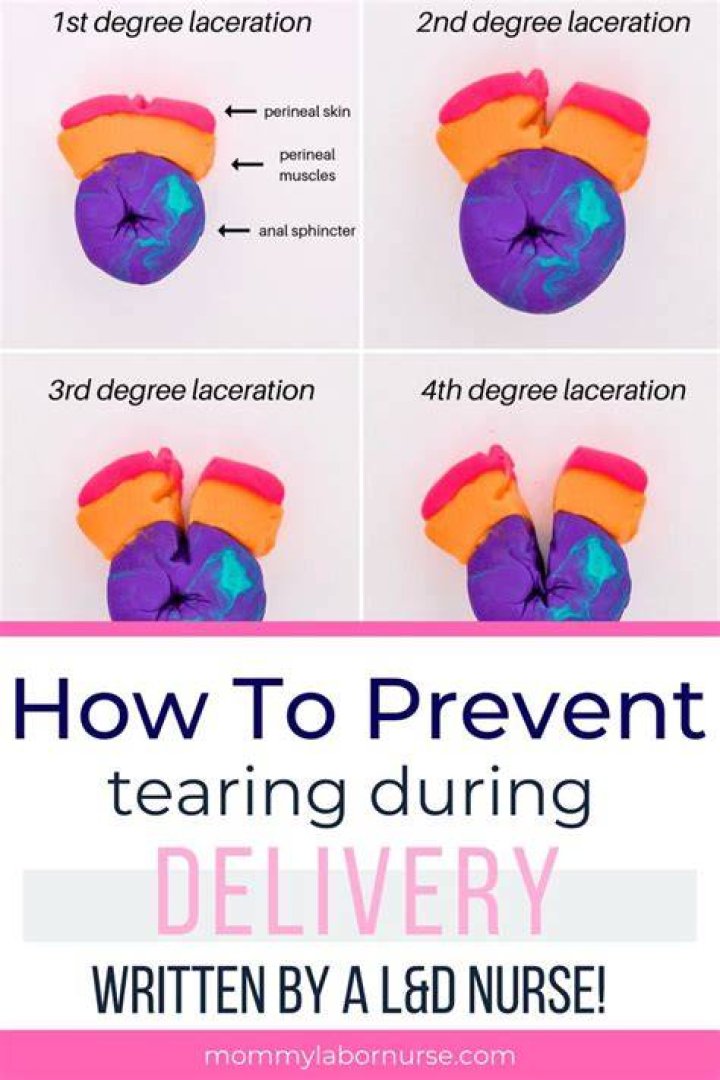 How can I prevent tearing during delivery?