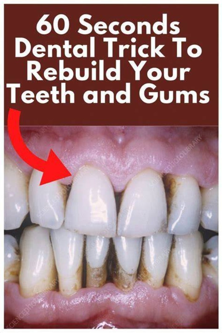 How can I rebuild my teeth naturally?