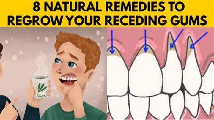 How can I regrow my receding gums naturally?