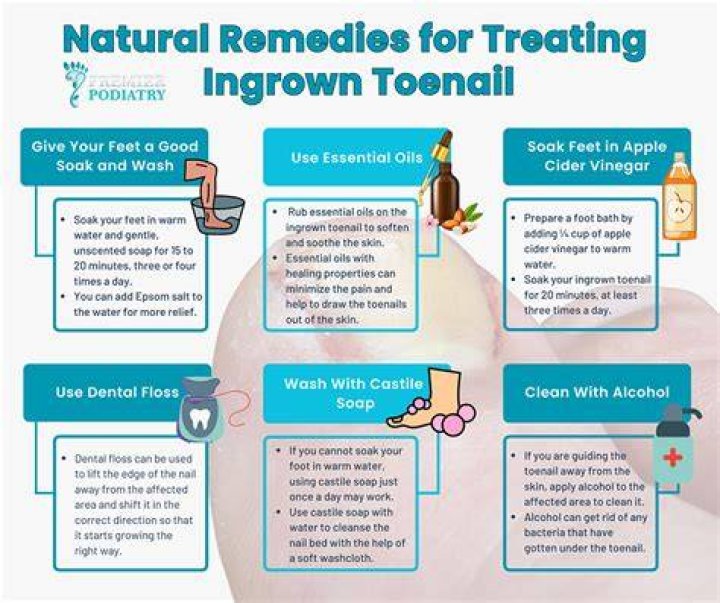 How can I remove an ingrown toenail myself?