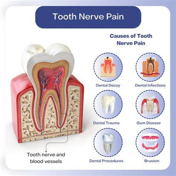 How can I soothe a nerve in my tooth?