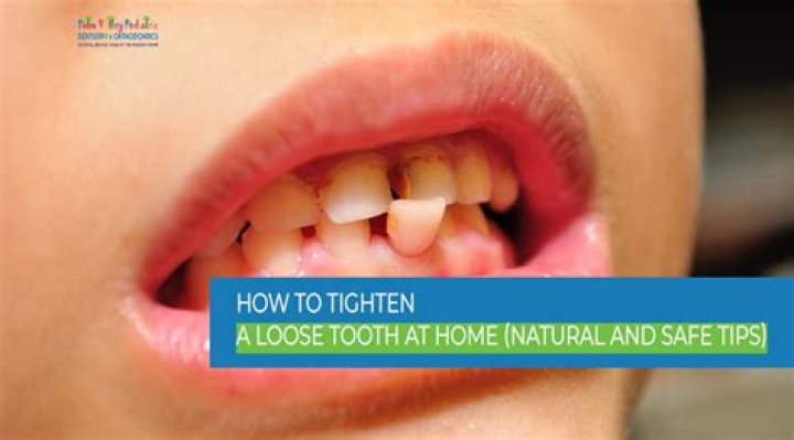 How can I tighten my teeth?