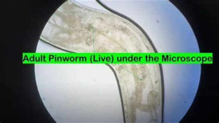 How do adults know if they have pinworms?