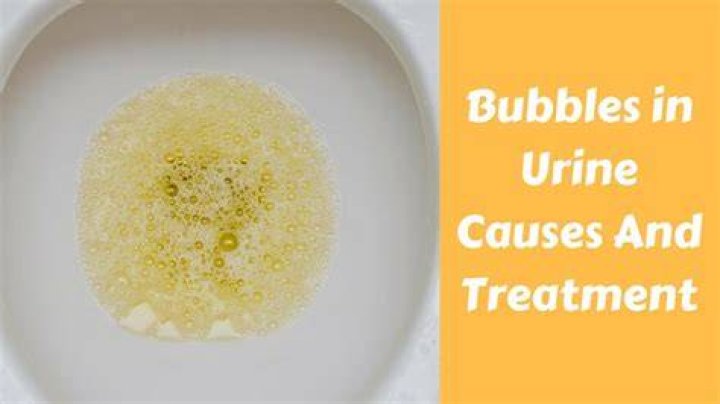 How do I get rid of bubbles in my urine?