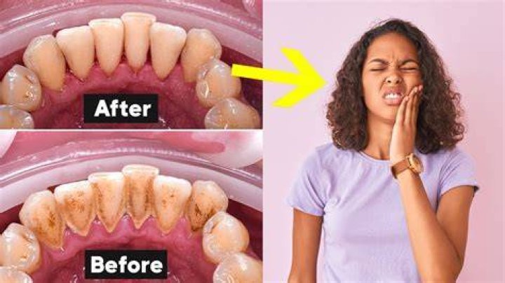 How do I know if my teeth are clean?