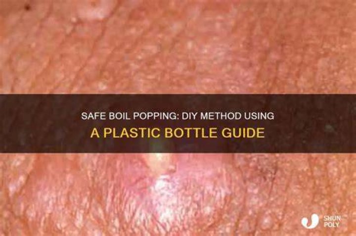 How do u pop a boil?