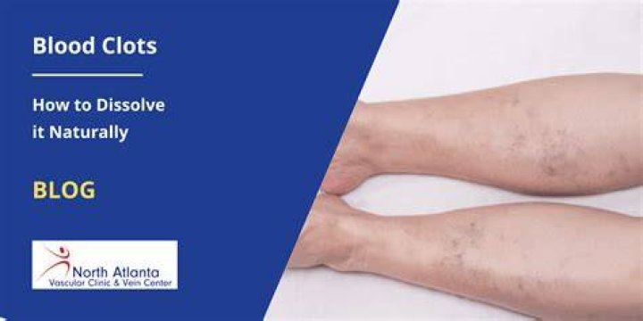 How do you dissolve a blood clot naturally?