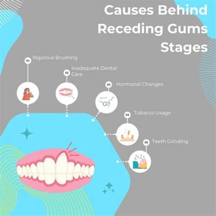 How do you fix severely receding gums?