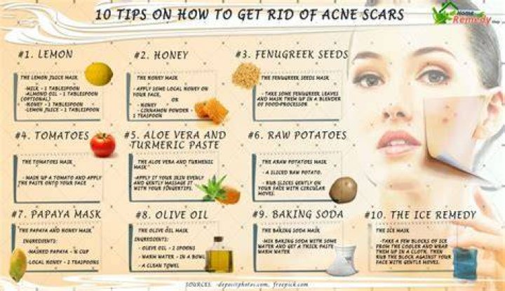 How do you get rid of dark acne scars?