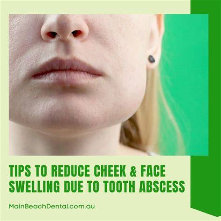 How do you get the swelling down from an abscess?