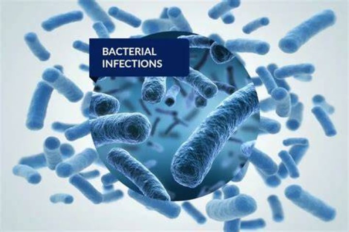 How long can a bacterial infection last?