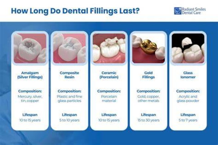 How long do tooth fillings last?
