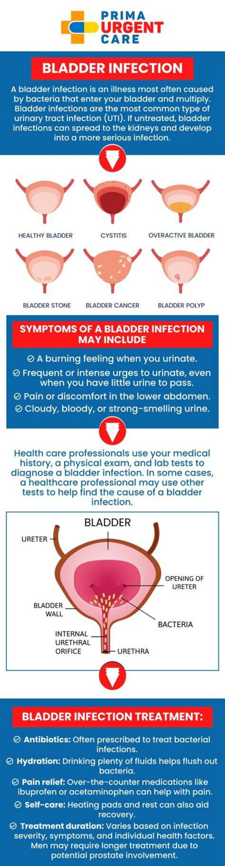 How long does a bladder infection last?