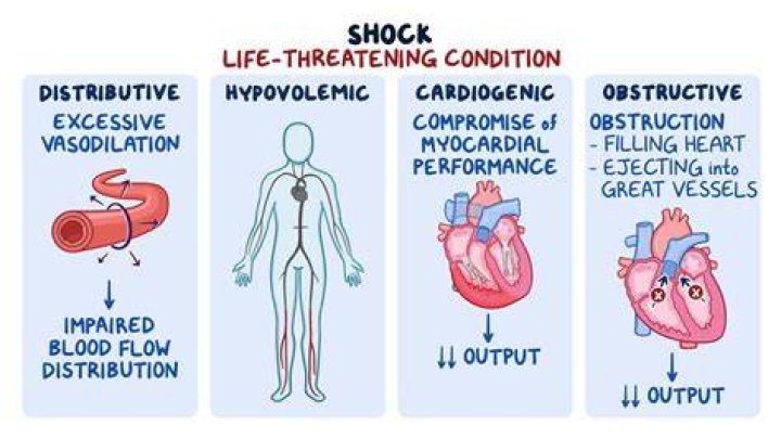 How long does disorientation last after stroke?