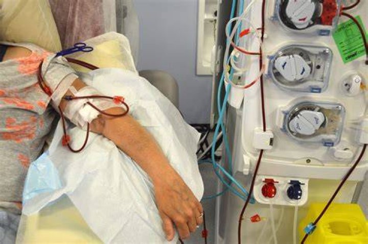 How long is a dialysis session?