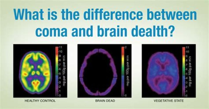 How long is clinically dead?
