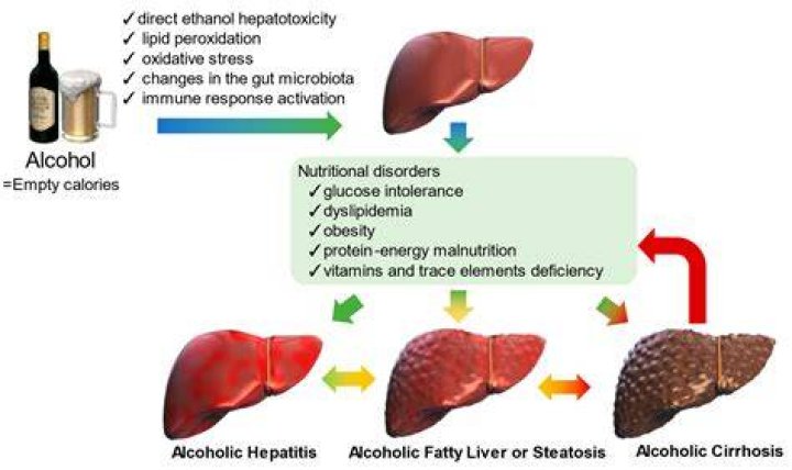 How much would you have to drink to damage your liver?