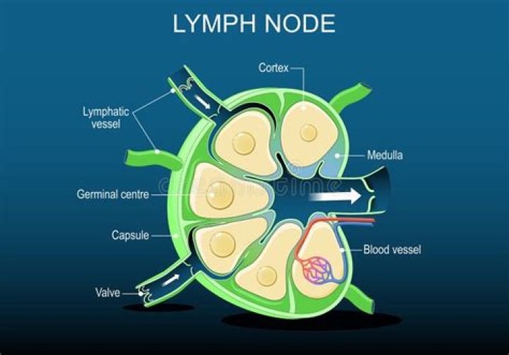 Is a 2 cm lymph node big?