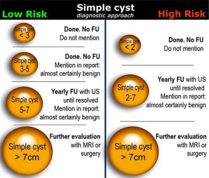 Is a 4 cm ovarian cyst big?