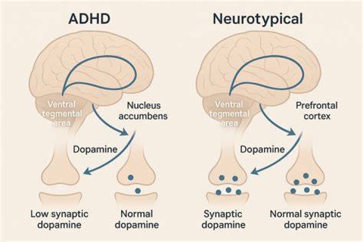 Is ADHD chemical or neurological?