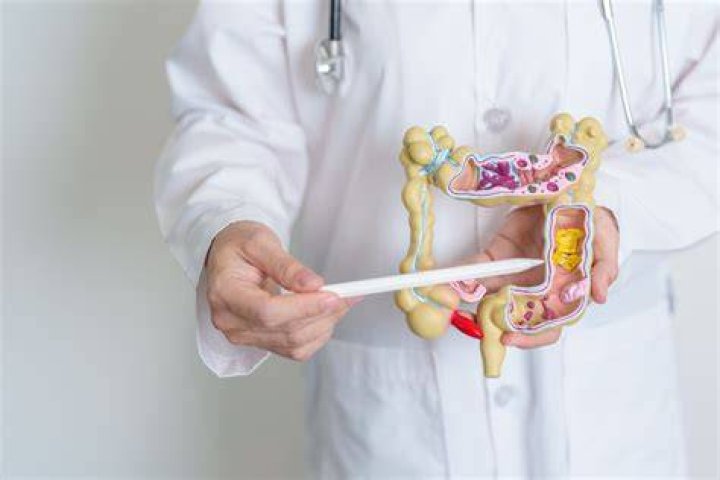 Is cologuard just as good as a colonoscopy?