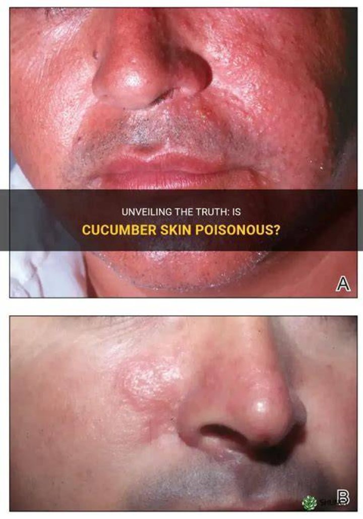 Is cucumber skin toxic?