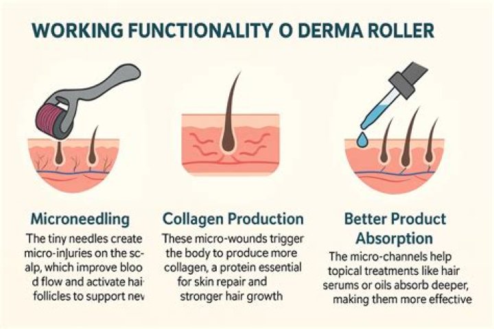 Is Derma Roller really effective?